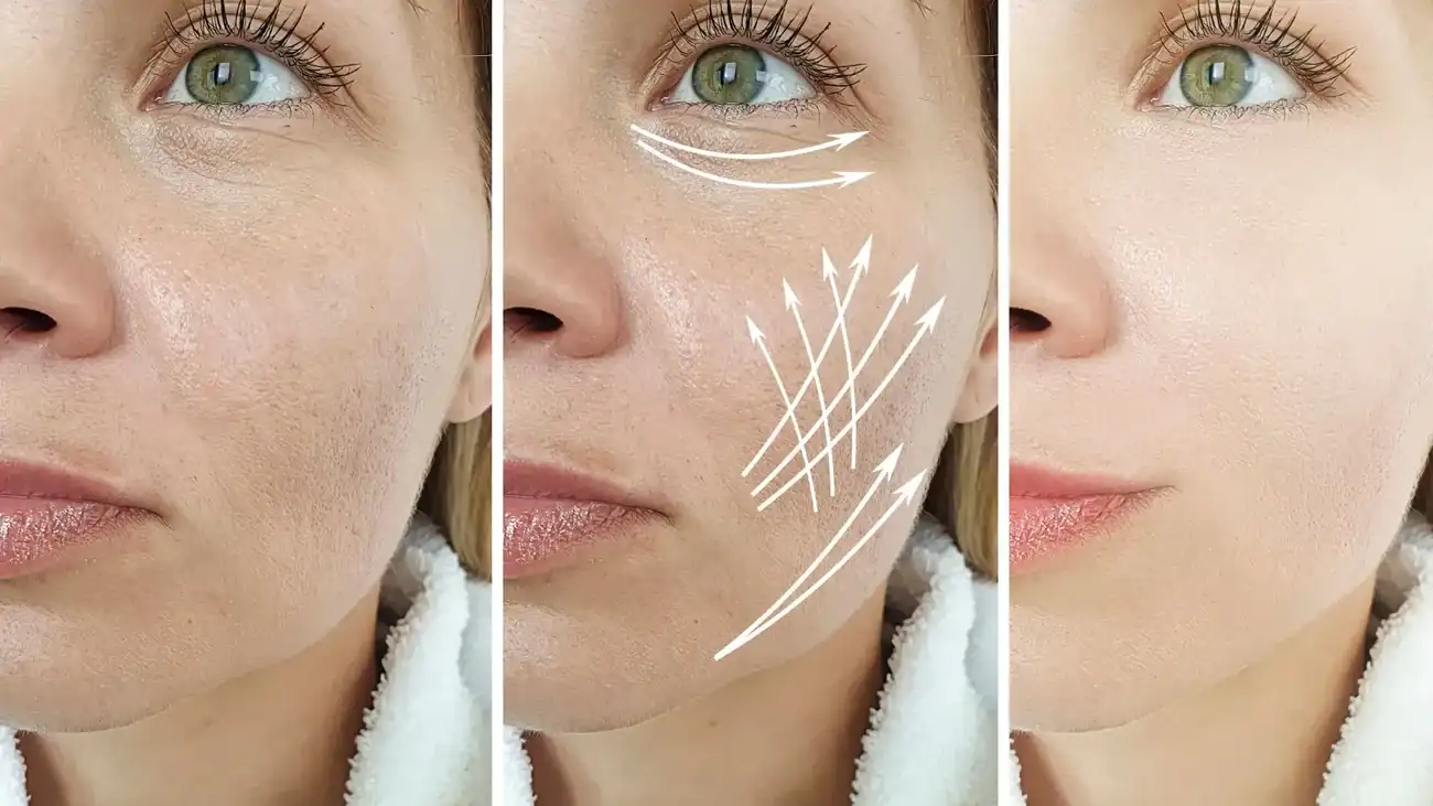 Can One Treatment Really Tackle More Than One Skin Concern Chinnor?