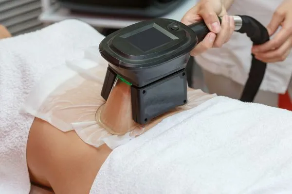 Image of person having fat freezing treatment to help weight gain Chinnor