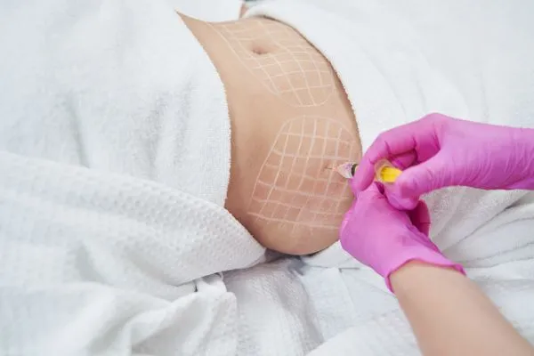 image of fat dissolving injections on love handles to help combat weight gain Chinnor