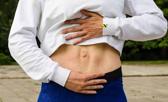 When Could Diastasis Recti Be the Missing Piece of the Puzzle Chinnor?